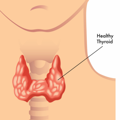 healthy and enlarged thyroid