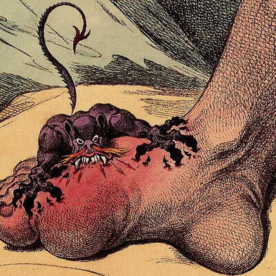gout cartoon by james gillray